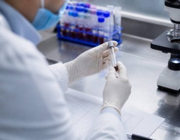 Risques pfas santé : quels effets sur l’organisme humain et animal