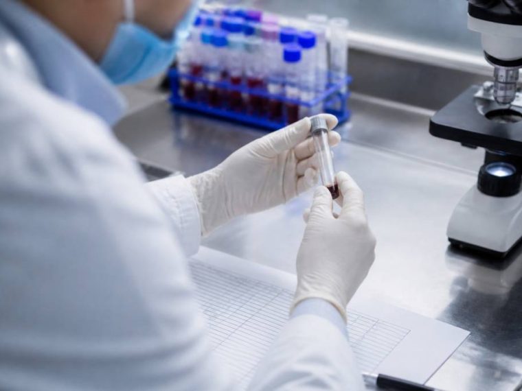 Risques pfas santé : quels effets sur l’organisme humain et animal